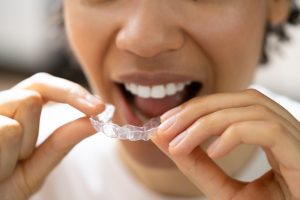 woman putting in a clear aligner