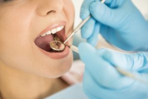 dental exam