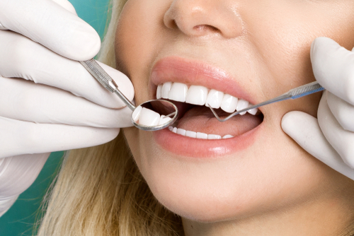 woman with freshly whitened teeth