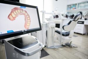3D dental scan