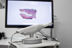 iTero Scanner