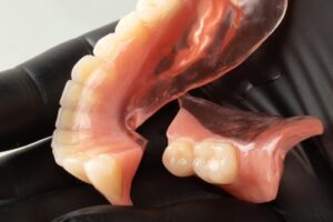 Broken,Lower,Complete,Denture,On,Hand,Of,Dentist